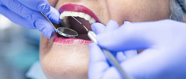 Best Knocked-Out Tooth Emergency  in Hollister, MO